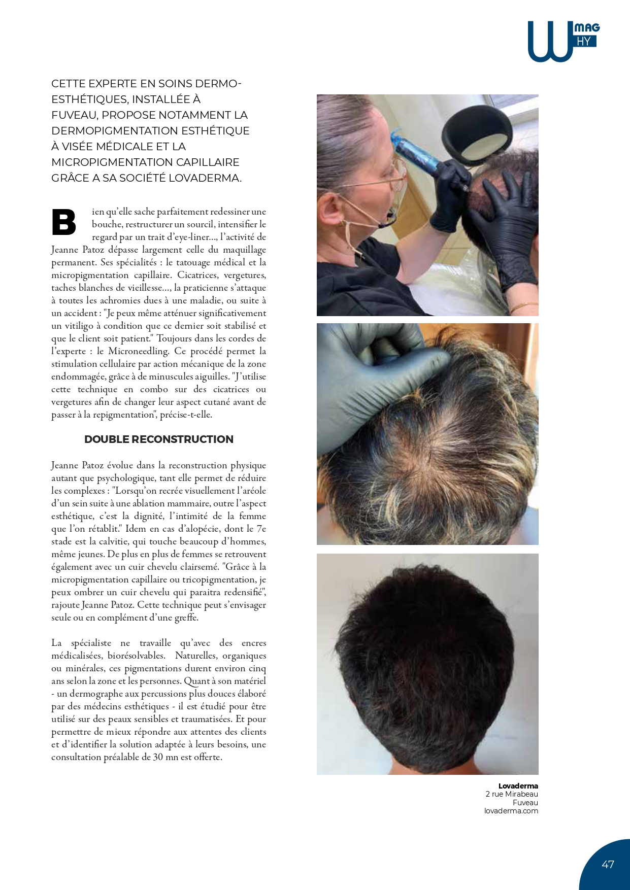 article tricopigmentation